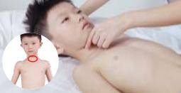 儿童扁桃体炎养生堂,穴位贴敷治疗小儿扁桃体