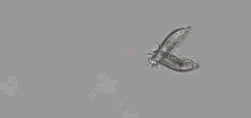 斑节对虾养殖过程中纤毛虫的危害,青蟹纤毛虫病图片及防治