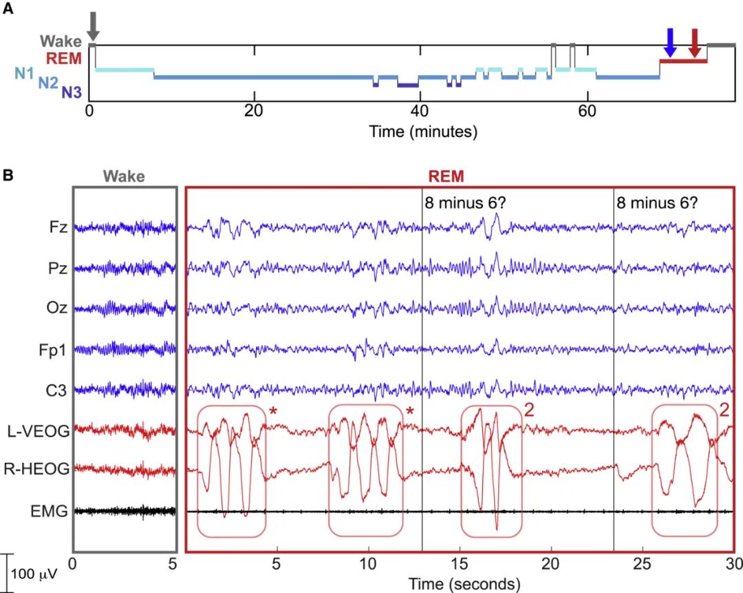 睡着了还能解数学题？研究发现，未来我们也许可以边睡觉边学习