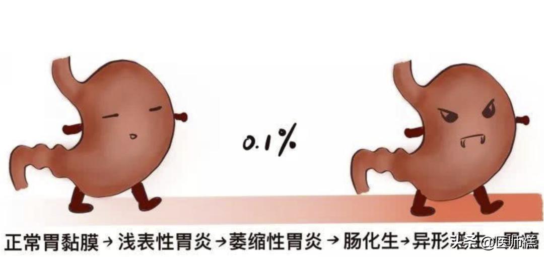 胃炎迁延不愈,胃炎久治不愈需要再做胃镜吗