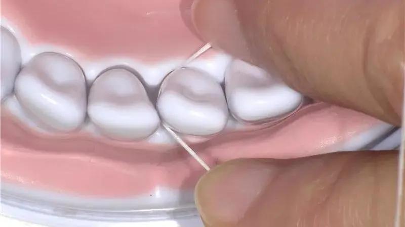 拒绝蛀牙幼儿,儿童拒绝治牙怎么办