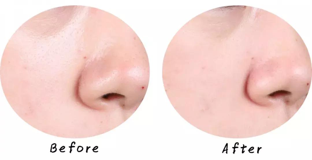 最好用清洁面膜排行榜前十名图片,公认最好用的清洁面膜混油皮