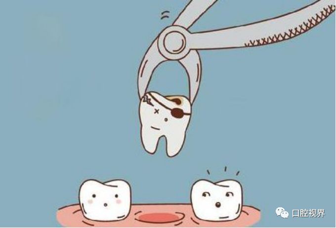 拔牙后的十大注意事项,月经期拔牙注意事项与禁忌症