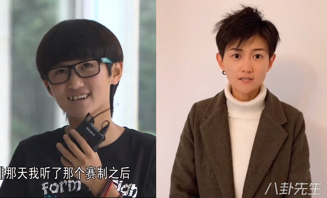 各届超女整容,2015年超女整容失败新闻案例