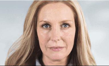 王菲的童颜针是什么牌子,王菲打童颜针真的有效吗