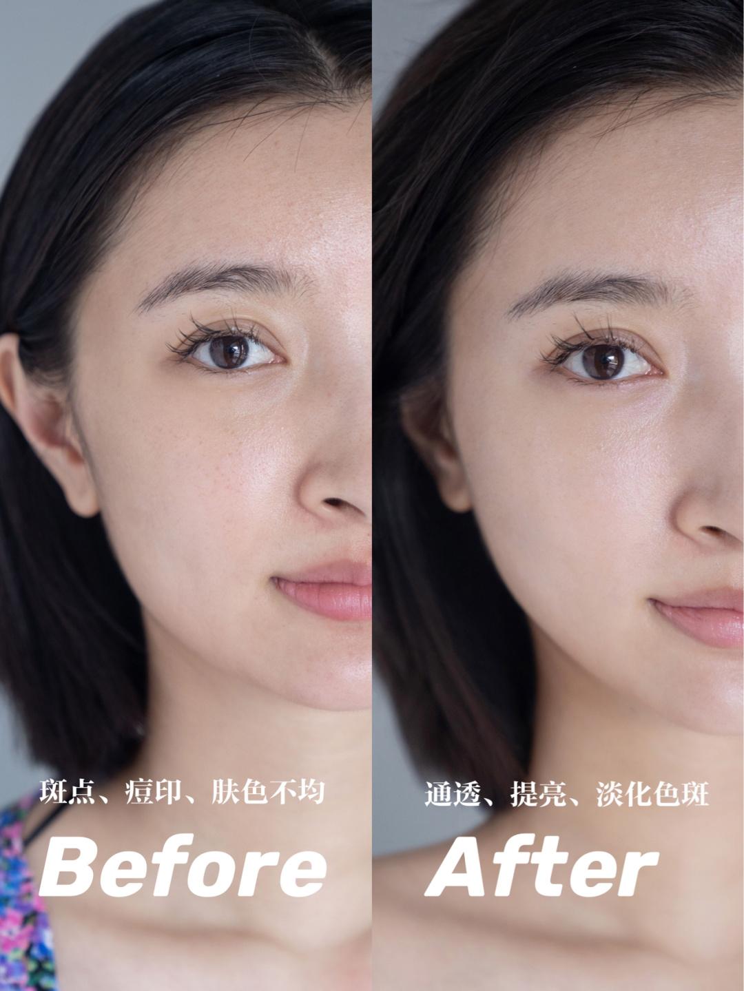 科颜氏淡斑小白瓶和小灯泡哪个好,科颜氏提亮美白