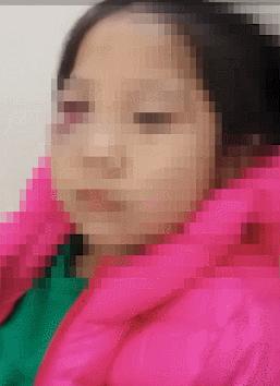 7岁女孩被老师打出血印,孩子被老师打的嘴巴出血
