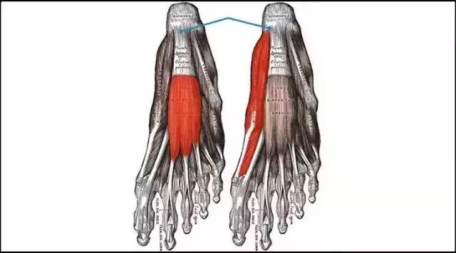 足跟痛怎么办要用什么药,足跟痛什么原因怎么治疗