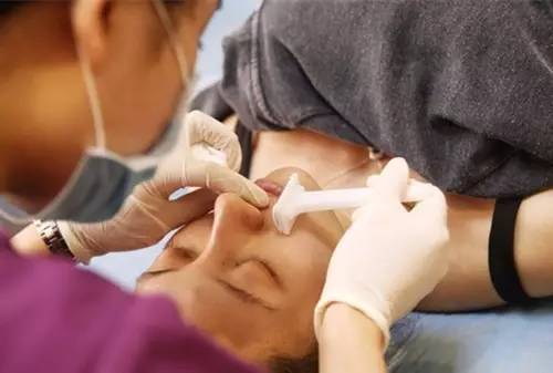 激光脱唇毛真实测评,去唇毛前后对比