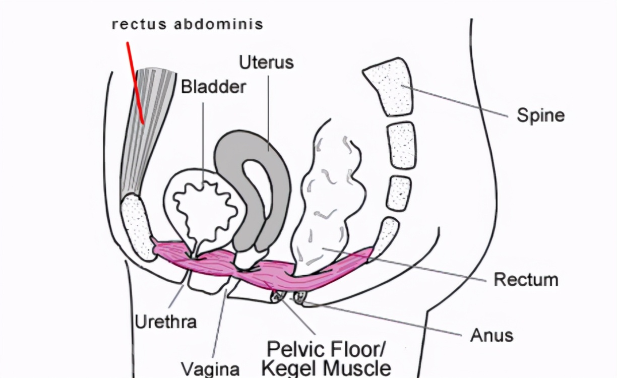 产后漏尿骨盆前倾可以做什么运动,产后十年了漏尿怎么通过运动改善