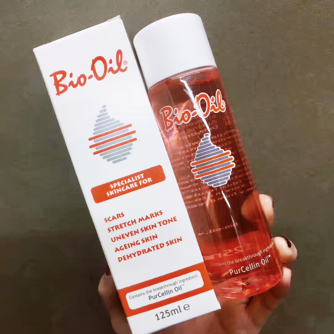 孕妈刚开始长妊娠纹的2个特征,哪些孕妈妈容易出现妊娠纹