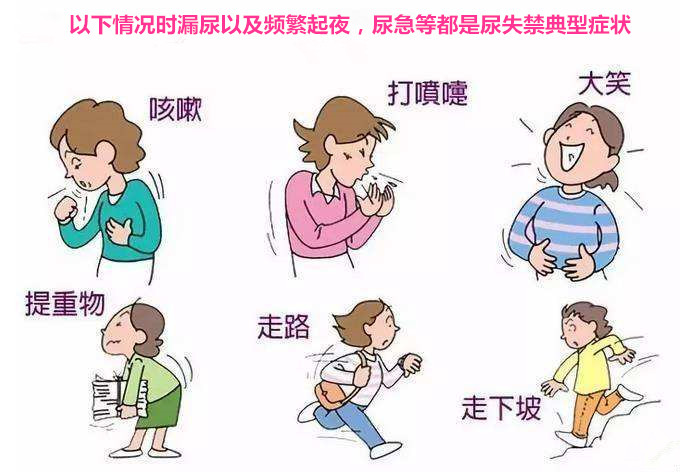 笑就漏尿可以治好吗,笑尿了是病吗