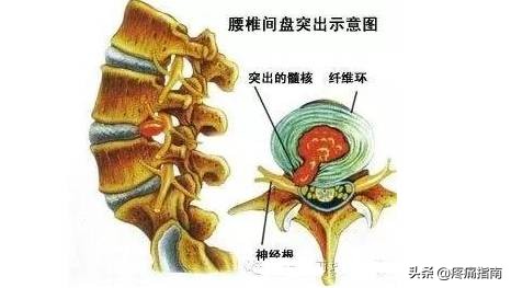 疼痛调理手法,疼痛治疗技巧视频
