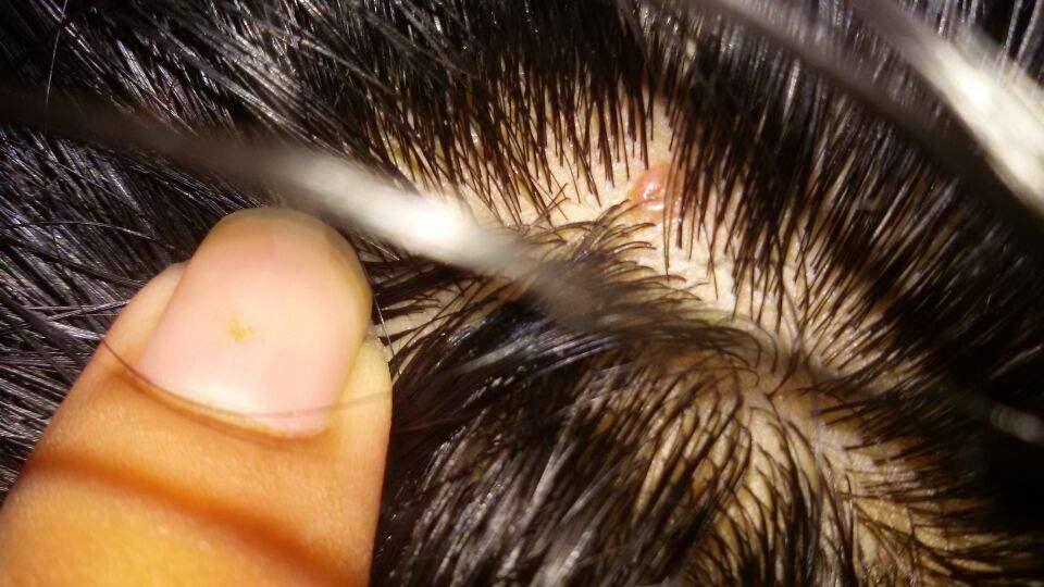 洗发露油性头发推荐,油头用了滋润洗发水