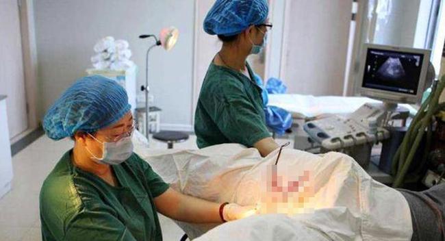 60多天流产下来的胎囊形状,60天流产出来的婴儿感觉到痛吗