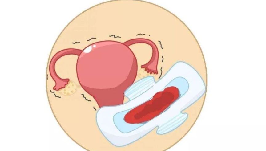 子宫异常出血停止后还会出血吗,子宫异常出血做了诊刮后还出血