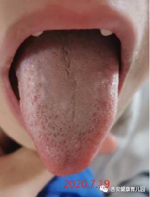 肺脾两虚咳嗽药膳食疗方,宝宝咳嗽的最佳食疗方法