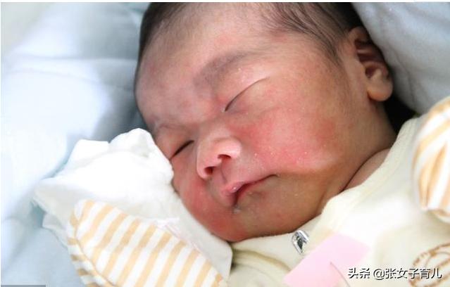 夏天宝宝长痱子有什么好办法吗,宝宝一到夏天就长痱子怎么办