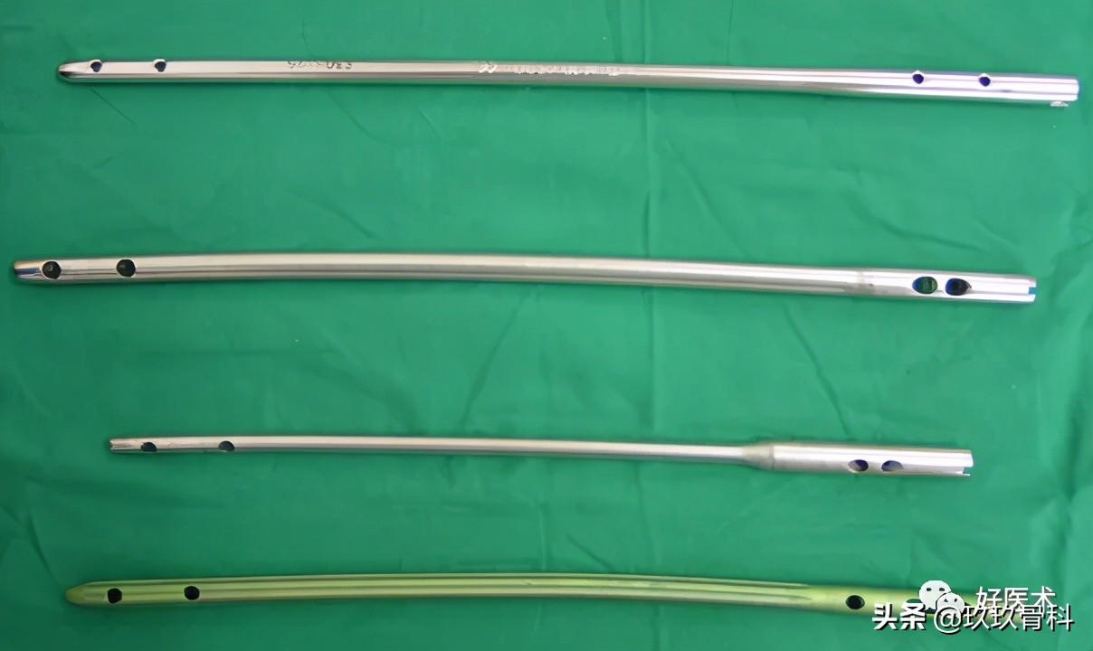 髓内钉技巧,髓内钉教学视频讲解