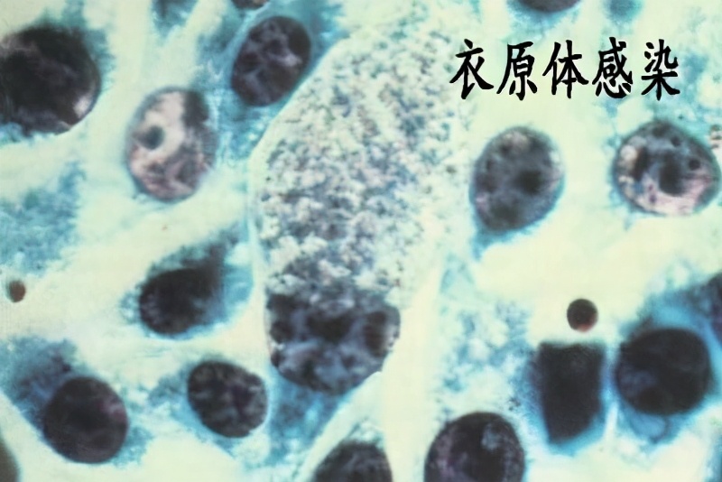 都安全小黄盒|不孕为什么要做支原体、衣原体检查？