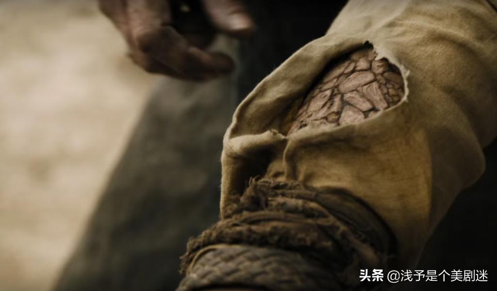 《权力的游戏》既然灰鳞病是一种致死疾病，为何还能让人治愈呢？