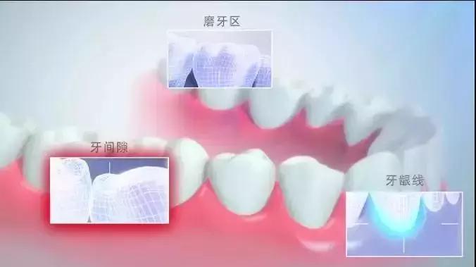 抖音美牙仪是真的吗,使用美牙仪的抖音网红靠谱吗