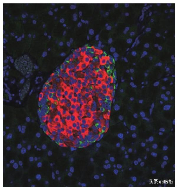 科普什么是糖尿病前期,科普中医什么是糖尿病