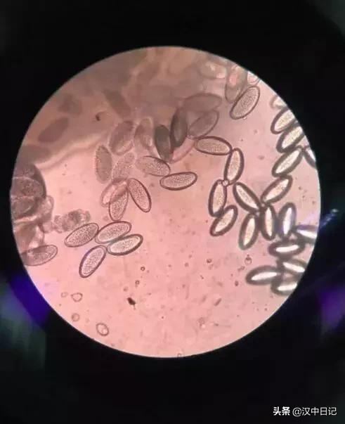 去医院怎么查孩子是否有虫,家有女儿的宝妈们看过来