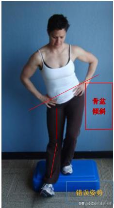 老生常谈跑步膝：髂胫束综合征（ITBS）