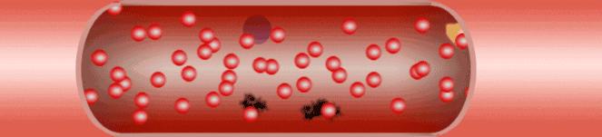 深蹲膝关节弹响怎么解决,深蹲膝关节响