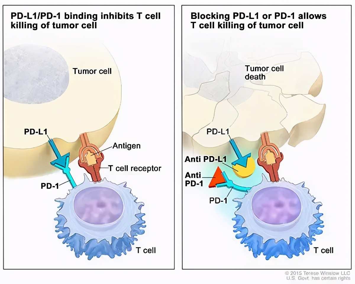 更好的免疫治疗来啦！逆转“PD-1无效”，肺癌治愈可期
