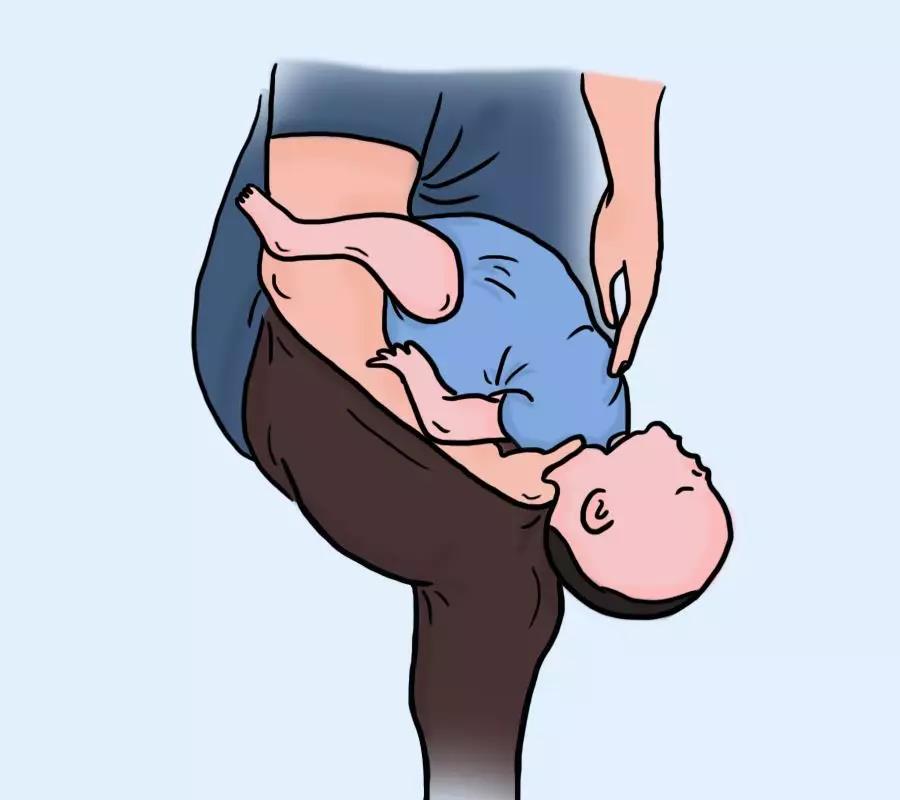 食物卡喉怎么办？这个救命技能人人都该会