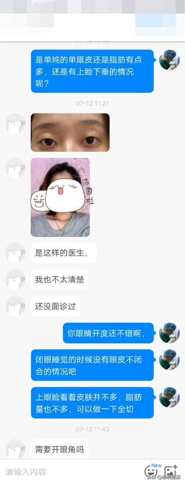 整形医生科普割双眼皮必看攻略,割双眼皮一定好看吗