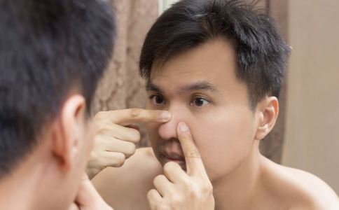 粉刺怎么彻底去除,闭口粉刺正确消除方法