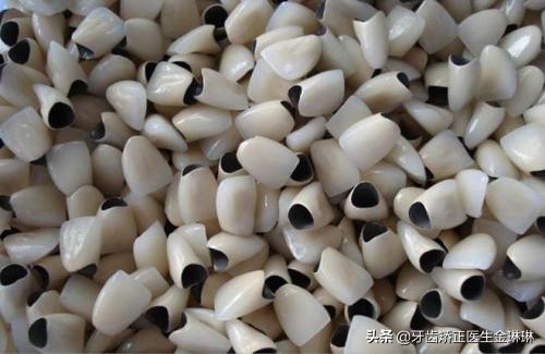 山东烤瓷牙什么牌子好,乌市烤瓷牙全瓷的多少钱一颗