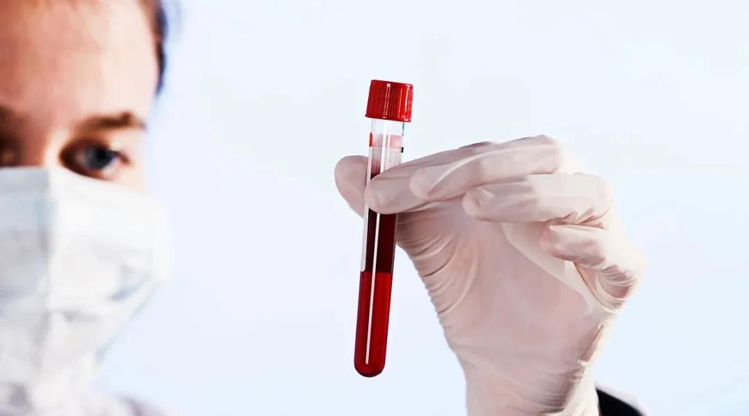 胆碱酯酶检查是13.86高吗,胆碱酯酶是检查哪个功能的