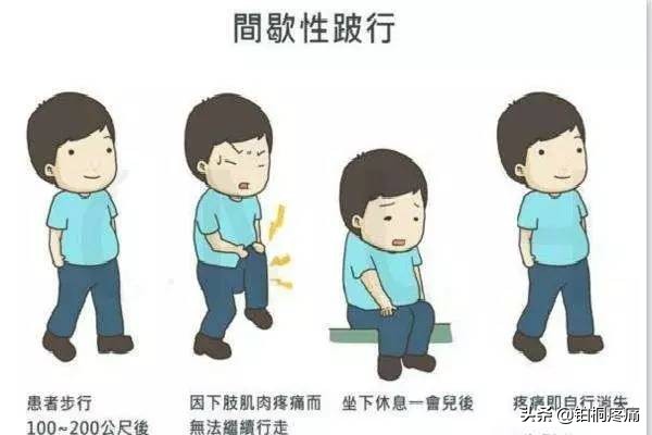 年龄大腰变粗是什么原因,85岁老年人腰腿疼痛最佳解决办法