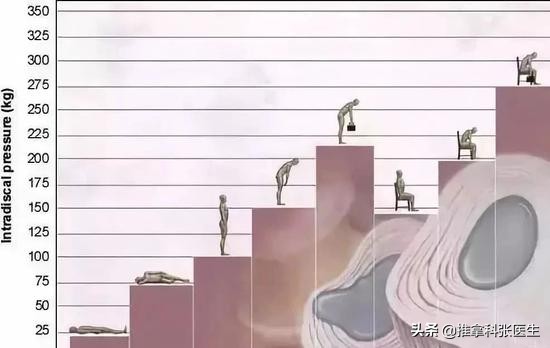 t12-l1椎间盘突出要怎么锻炼,腰4-5椎间盘突出压迫神经怎么锻炼