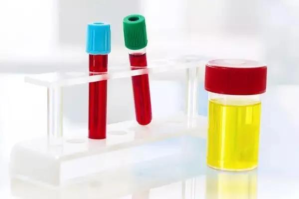 医生说我尿血买啥药治疗快,怀疑有血尿怎么办