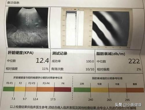 乙肝携带最新用药指南,乙肝病毒携带者的诊断及治疗