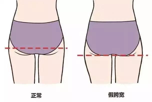 健身房改善假胯宽最有效,健身直播胯宽咋练