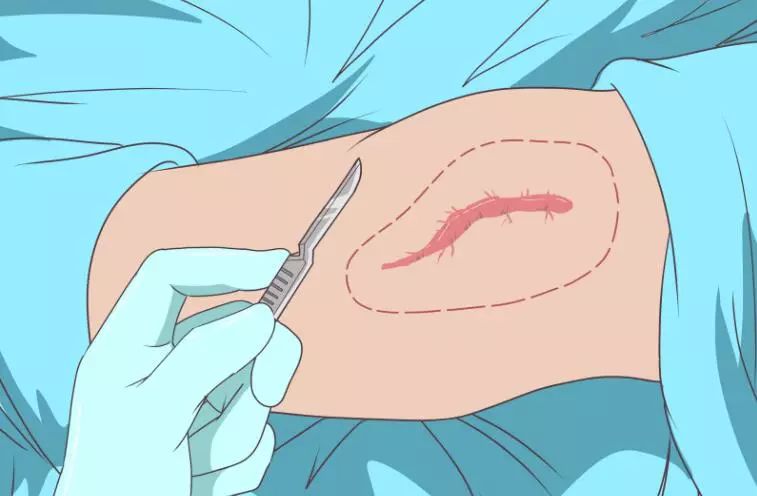 疤痕护理软膏可以修复疤痕吗,祛疤痕药能彻底祛疤吗