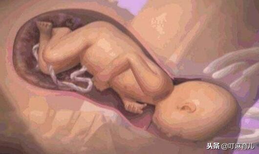 胎儿双顶径偏大可以顺产吗,胎儿双顶径超过10cm可以顺产吗