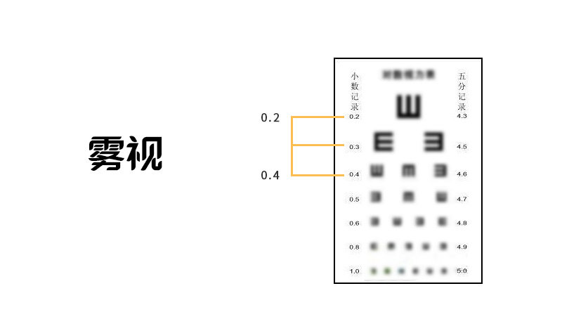 配眼镜验光流程讲解,网上配眼镜怎么验光的流程