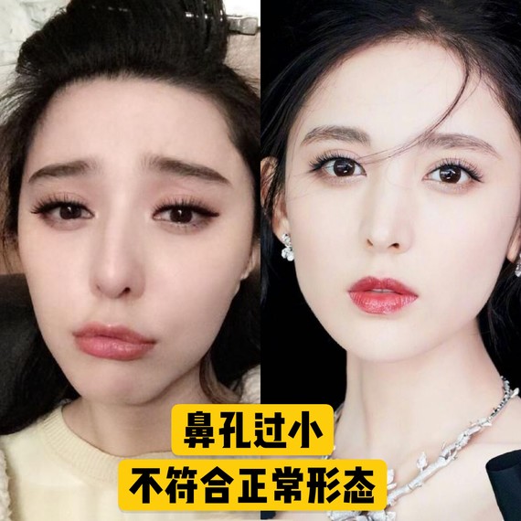 好看的鼻子类型驼峰鼻,好看的鼻型有哪几种