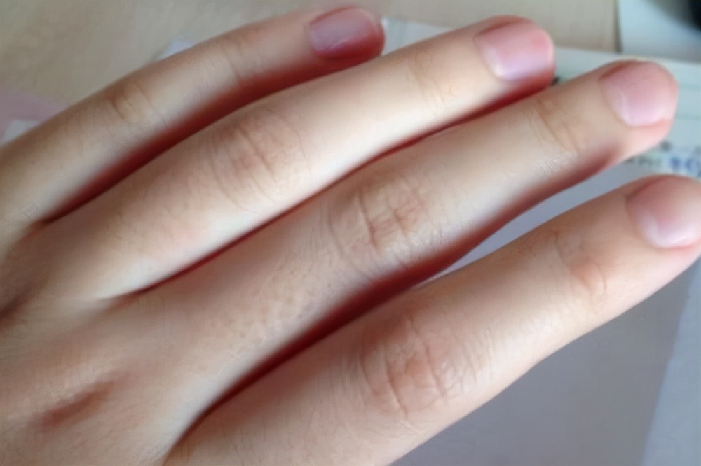 女人怎么补气养血效果好,补气养血女人学会这五招就够了