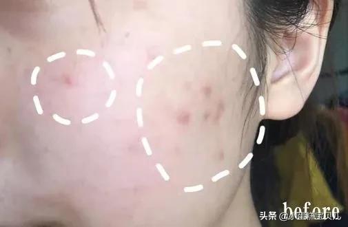 床单不洗螨虫成千上万,床单30天不洗竟螨虫成堆