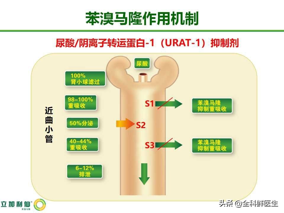 痛风石的治疗方案,痛风石怎么医治要做手术吗