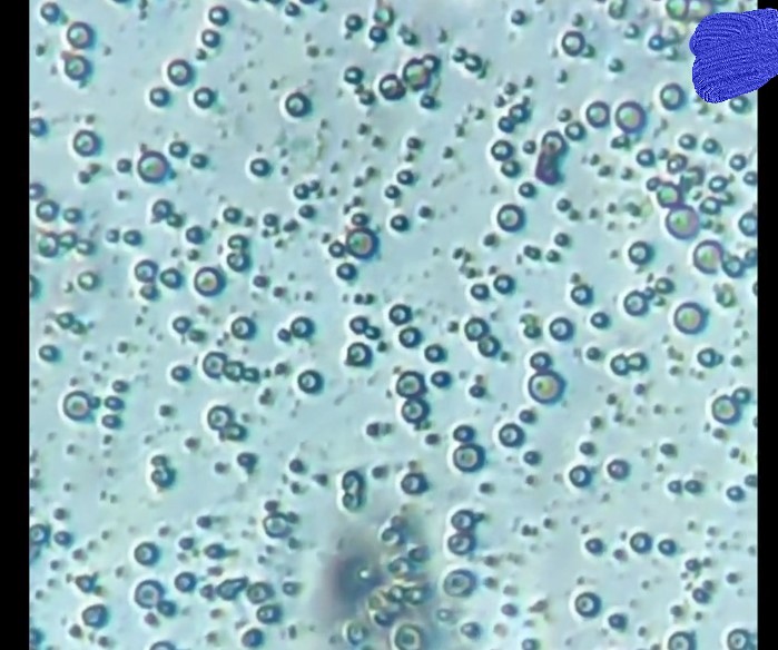 显微镜放大1000倍现原形,母乳在显微镜下被放大1000倍