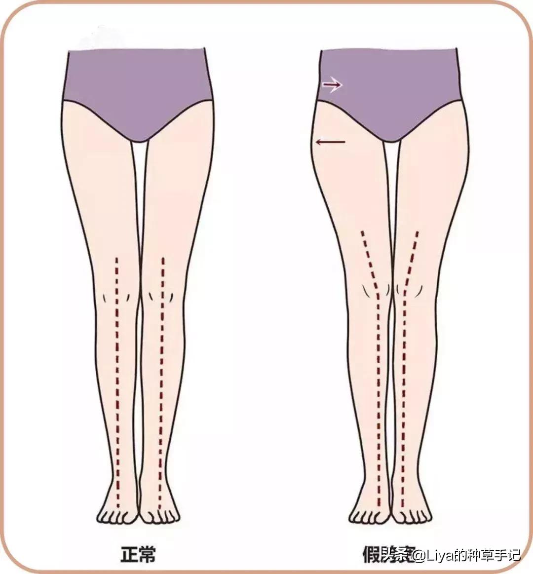 胯宽屁股大真的可以改善吗,屁股大胯宽有什么好